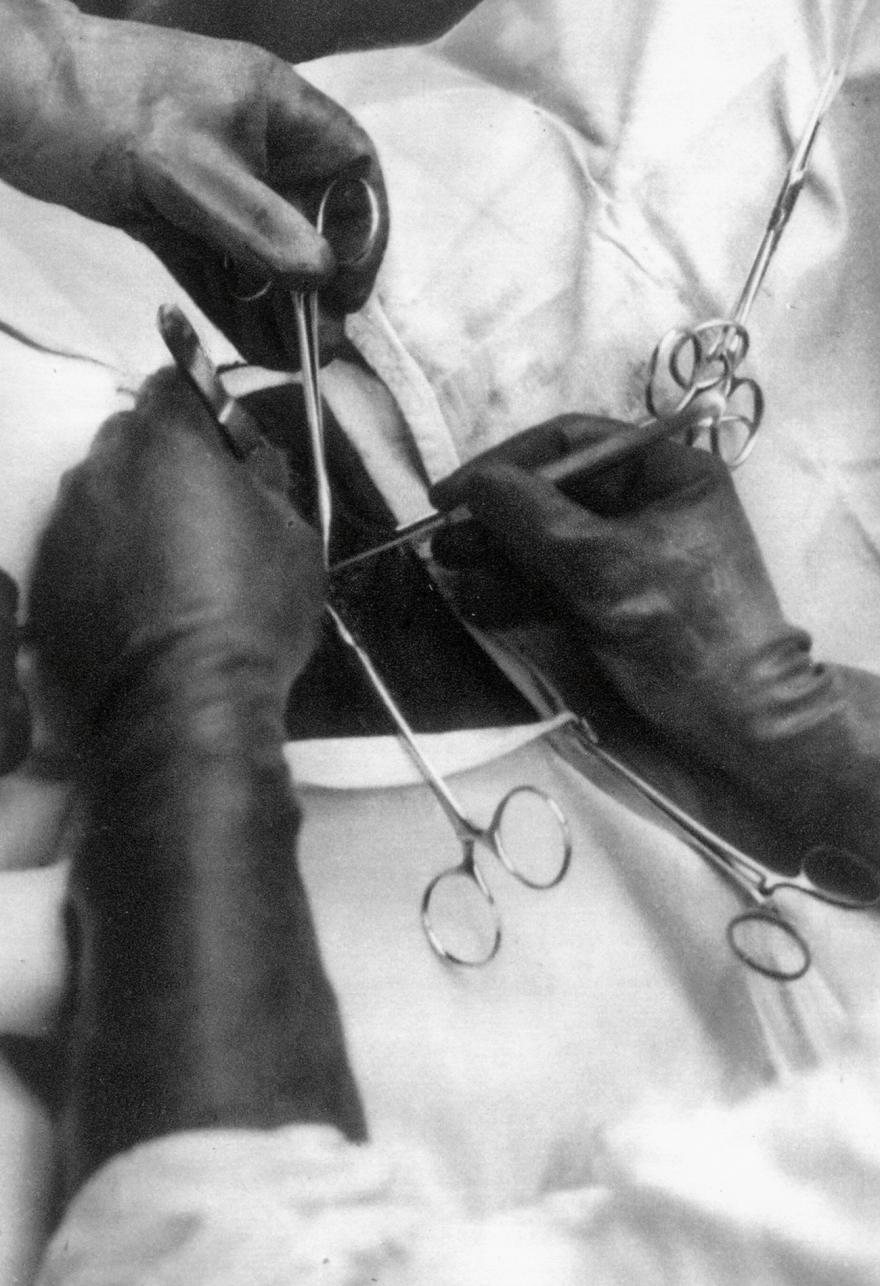 Jean Roubier, Hôpital Beaujon, Opération chirurgicale, 1933 (avant)